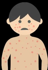 Hematomas y puntos rojos